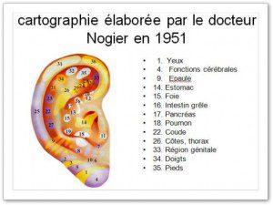 auriculotherapie